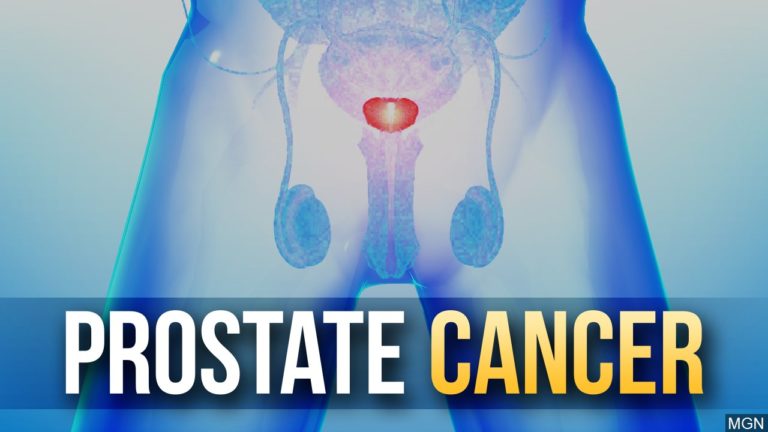Prostate cancer