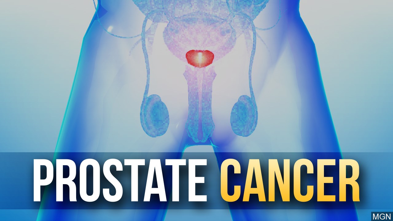 Prostate Cancer Meaning In Nepali